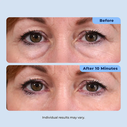 Rapid Reduction Serum – 1-Month Supply