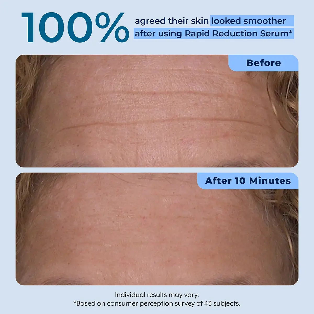 Rapid Reduction Serum – 1-Month Supply